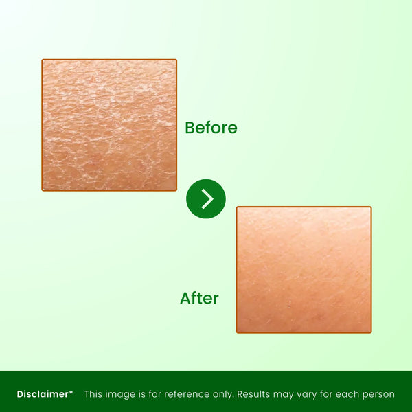 Aloevera Infused Cold Cream