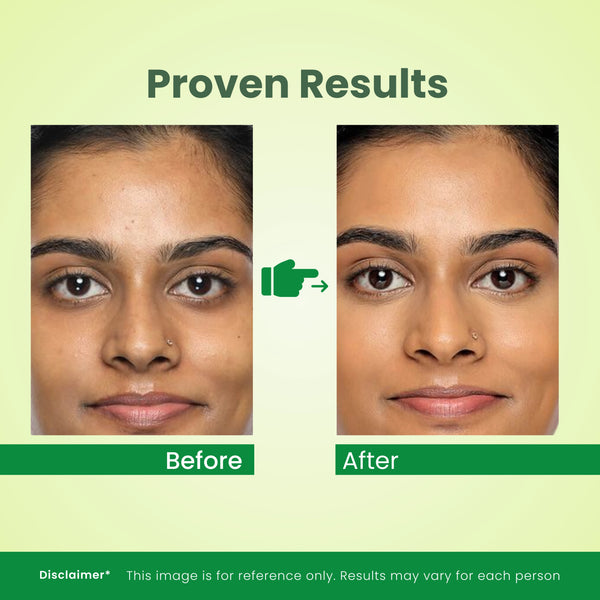 Greenmedi Glycerin Soap