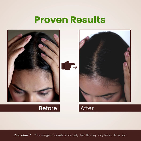 Amla Aritha Shikakai Soap